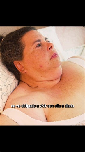 Understanding Obesity in Women: A Deep Dive