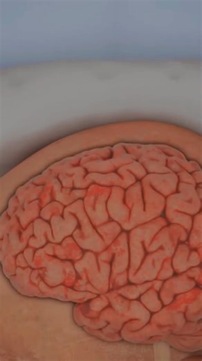 2.5K views | 3D Animation of Brain Surgery #shorts #reesl #facbookReelscontest #doctor #DoctorWho #doctorsofinstagram #documentaryphotography | SMART Doctor | Facebook