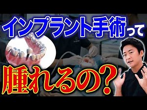 前歯と奥歯でこんなに違う？インプラント手術の難しさと腫れ具合についてインプラント専門家が解説