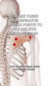 Release These Infraspinatus Trigger Points To Help Relieve Shoulder Pain 👉 The infraspinatus is a muscle located in the shoulder blade region that plays an important role in shoulder and arm movement, as well as shoulder stability as part of the rotator cuff. 👉 The most common cause of trigger points in the infraspinatus is overuse or misuse of the muscle, which can be due to poor posture, repetitive overhead activities, and sports that require repetitive arm and shoulder movements. 👉 Treatme