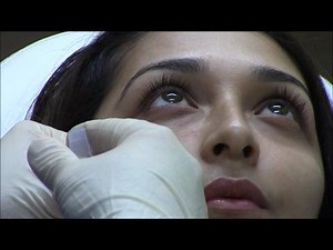 Restoring Lost Volume Under the Eyes With Restylane