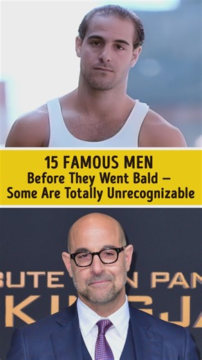15 Famous Men Before They Went Bald — Some Are Totally Unrecognizable | You're Gorgeous