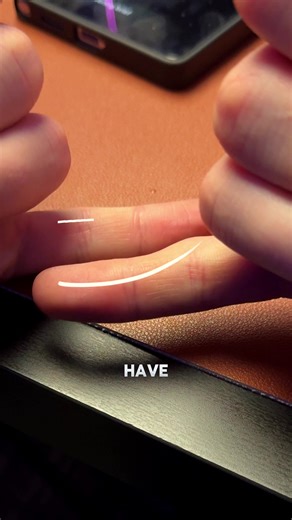 Understanding the Phone Pinky Habit