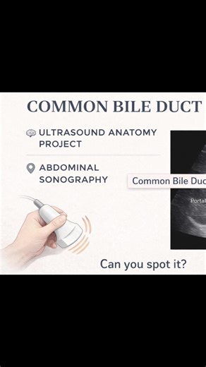 Learning to identify the Common Bile Duct on ultrasound 🖥️ One structure — so much clinical importance. #SonographyStudent #UltrasoundAnatomy #CommonBileDuct #AbdominalUltrasound #MedTok