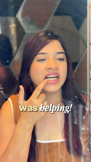 Himani Jain🧿 on Instagram: "Stained teeth can make you think twice before smiling for a selfie. With X-Tar, your smile gets its X-Factor. It works on old yellow stains and stops plaque and tartar deposits, giving you an X-traa white smile. . . . . . #teethwhitening #removetoothstains #toothpaste #whiteteeth #dentists"