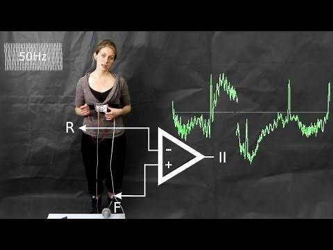 ECG: common artefacts and how to avoid them