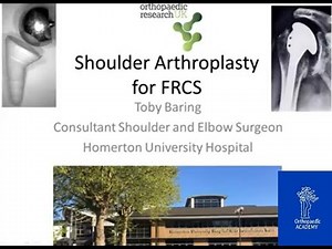 Shoulder Replacement • Video • MEDtube.net