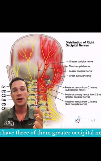 Occipital neuralgia is a painful condition involving one or more of the occipital nerves (greater, lesser or 3rd). The pain commonly is located below the skull and bheind the head. #occipitalneuralgia #headache #on #uccnearme