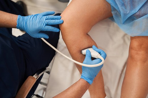 Échographie-doppler (ou échodoppler) : définition, déroulement, prix