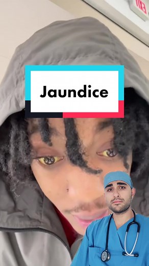 Jaundice or icterus is when your skin or the whites of your eyes turn yellow. It can be a sign of something serious, such as liver disease, so you need to get urgent medical help. #medicine #medical #medtok #icterus #jaundice