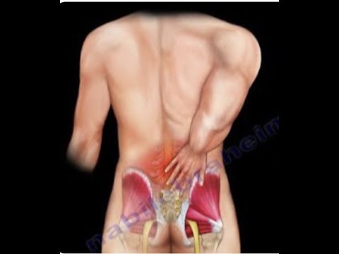LOW BACK PAIN causes, diagnosis and treatment Everything You Need To Know Dr Nabil Ebraheim