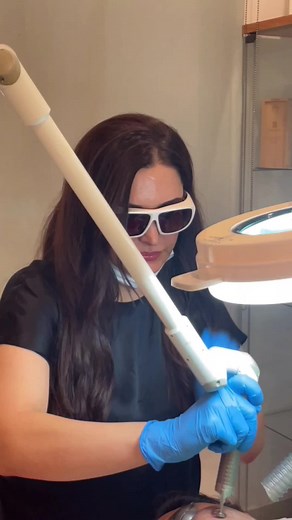 Ablative Erbium YAG Laser for Scar Removal