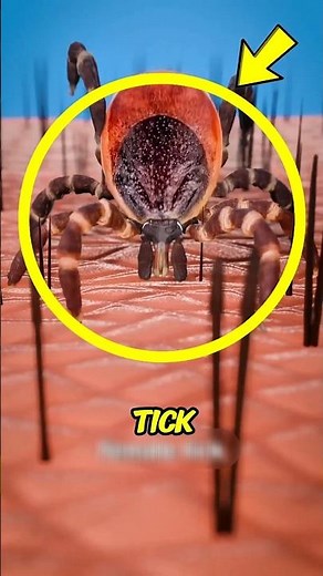 Why Removing a Tick the Wrong Way Can Leave It Inside Your Skin