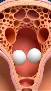 Twin Pregnancy Explained in 15 Seconds 👶👶 | 3D Animation#shorts #twins #baby #twinpregnancy