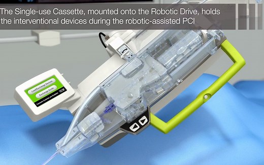 西门子旗下的血管介入机器人Corindus机器人辅助神经介入血管瘤栓塞研究How the CorPath GRX Cassette Works