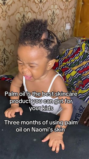 Three months of using palm oil on Naomi’s skin #fyp | palm oil
