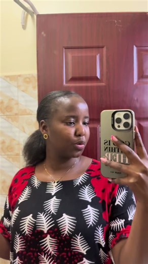 Hairline Restoration Progress: How I Improved My Natural Hairline