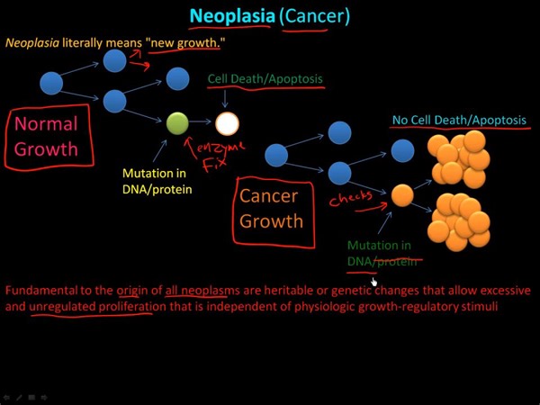 Pathology - Neoplasia