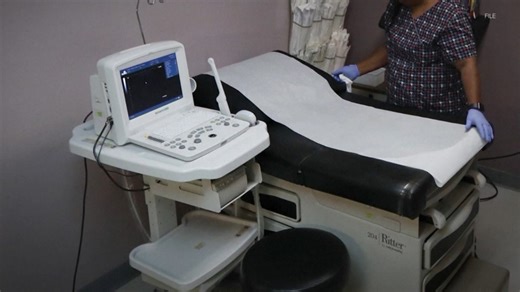 What is considered a fetal heartbeat and when can it be detected?