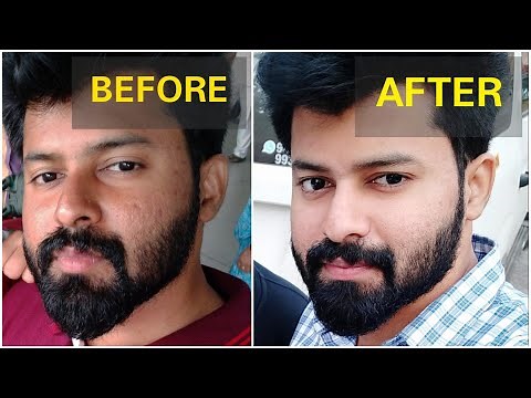 Get brighter skin Naturally in 2 Weeks | No side effects | Tamil | shadhikazeez