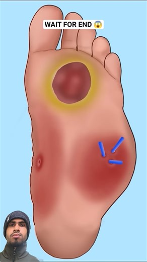 ASMR animation Leg piercing removal treatment P2 #asmr #animation #shortsvideo #trending