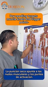 Educational Thursday: Acupuncture VS. Dry needling. Dr. Ortega goes over the differences between acupuncture and dry needling. When both are combined, the results are incredible! #acupuncturists #wellness #dryneedling #educational #relief #painmanagement #chronicpainrelief #orlandoflorida #explore #fyp | Horizon Integrative Medicine