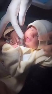 If You Had THIS As A Baby, You May Be Lucky! 👶🍀 #babyteeth #baby #dentist | TheBentistofficial