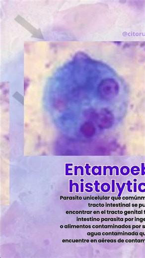 La Entamoeba histolytica es un parásito de la amebiasis