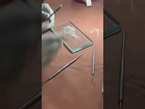 Manipulate of zinc phosphate and amalgam restoration!