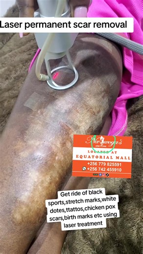 #kampalatiktokers #foryoupage #kampala_uganda #goviral