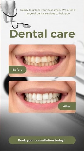 Gentle Dental Solutions: Braces, Implants, & Root Canal Experts Near You
