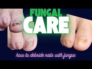 20+ year FUNGAL infection can finally begin to HEAL! #pedicuretutorial #nailfungus