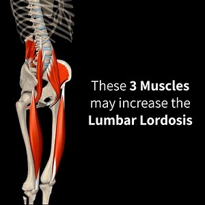 Muscle & Motion on Instagram: "Remember yesterday's question? 🧑‍🏫 Well….the correct answer is 5️⃣, all of the above. This video presents each muscle and its exact impact on the pelvis when it shortens. In addition to the muscles in the video, the Sartorius also influences the position of the pelvis and can create an anterior tilt. Digging deeper into anatomy will help you identify and treat postural problems. Our POSTURE APP was co-founded with Dr. Gil Solberg, our posture master:) Check it ou