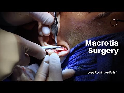 Macrotia Surgery
