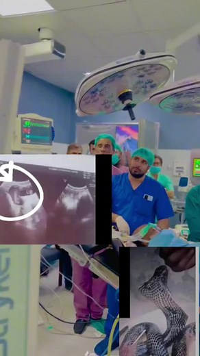 Understanding Medical Procedures: A Look at Ultrasounds