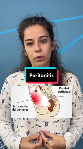 Todo sobre peritonitis: definición y tipos