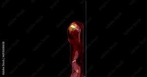 A PET-CT scan is a diagnostic imaging technique combining positron emission tomography (PET) and computed tomography (CT) in cancer diagnosis and staging.