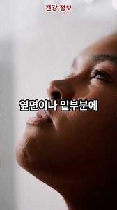 3주 안 낫는 구내염, 설암 신호입니다 | 20-30대도 위험