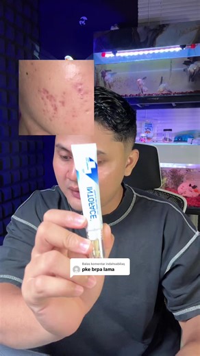 Tips Mengatasi Jerawat dan Bopeng dengan Laksapro26
