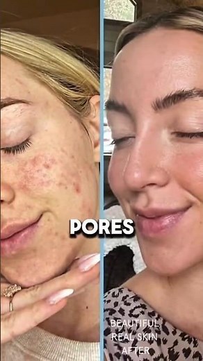 7-Day DIY Face Scrub for Glowing Skin | Natural Exfoliant That Works FAST!