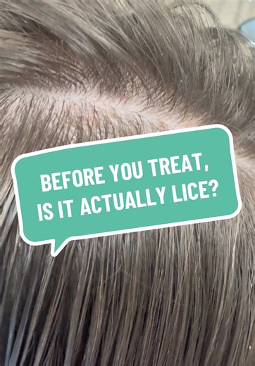 LiceCentersWI on TikTok