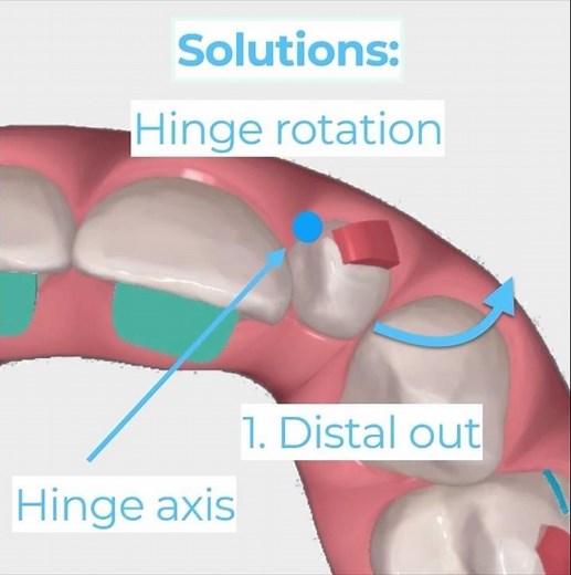 Hinge Rotation Explained