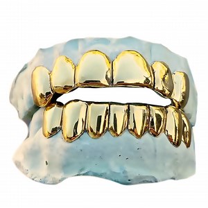 10K/14K Solid Gold Custom Grillz, Perm Cut, Handmade in USA - Etsy