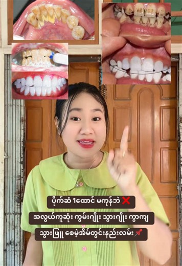 ကွမ်းဂျိုး သွားဖြူ စေမဲ့အိမ်တွင်းနည်းလမ်း