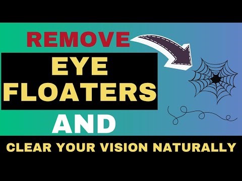 Eye floaters natural treatment || How to clear eye floaters || floaters & flashes