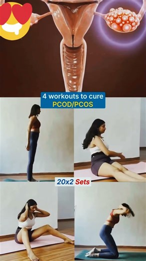 "PCOD/PCOS Workout: 4 Exercises to Improve Insulin Sensitivity and Hormonal Balance"*