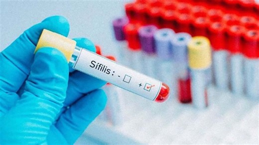 Crece el contagio de enfermedades de transmisión sexual: resaltan la importancia del preservativo