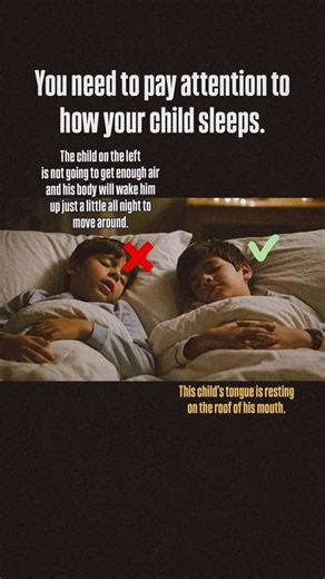 **Your child’s sleep problems might not be a behavior issue—it’s their tongue. 👅** If your child snores, breathes through their mouth, or wakes up tired even after a full night’s sleep, their tongue position could be blocking their airway. Here’s what most parents don’t realize: when the tongue sits too low during sleep, it causes dozens of micro-wake-ups every night. Your child never reaches deep sleep, which means their brain can’t process emotions or lock in what they learned that day. The m