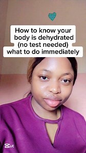 16K views · 165 reactions | How to know you’re dehydɍated (WITH0UT any Test) —and what to do immediately  Act fast because dehydration has k!lled alot of people! #selfcare #fblifestyle | Mimi Best Page | Facebook