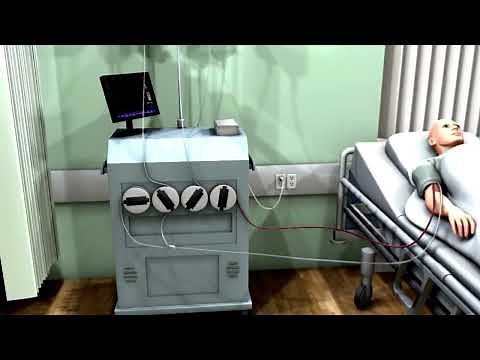 What is Plasmapheresis (Therapeutic Plasma Exchange)?